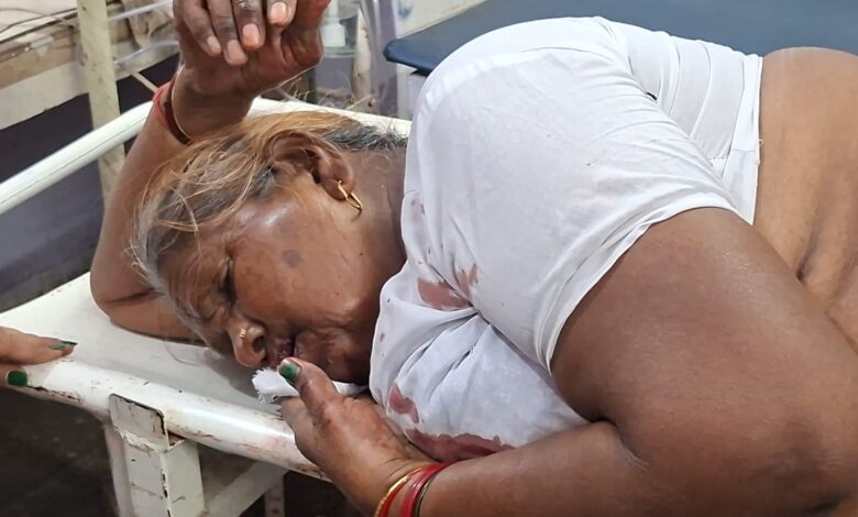 60 वर्षीय वृद्ध महिला को स्कूल बस ने मारी टक्कर